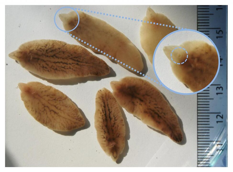 liver