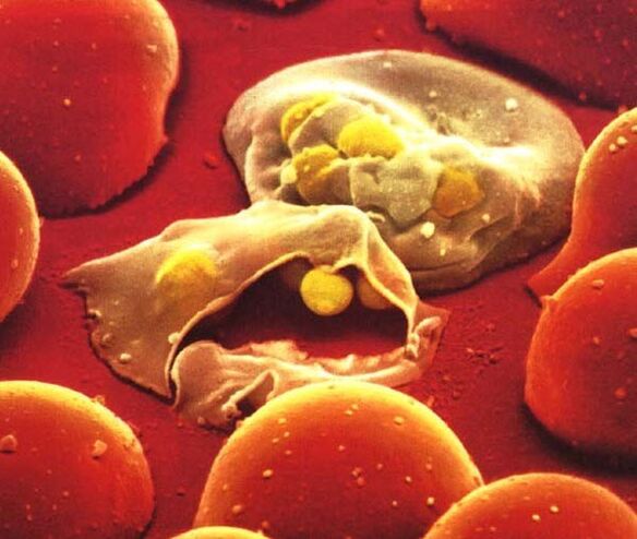 the simplest plasmodium of the malaria parasite