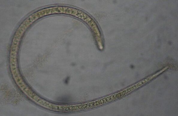 Trichinella is a parasitic round protostome worm