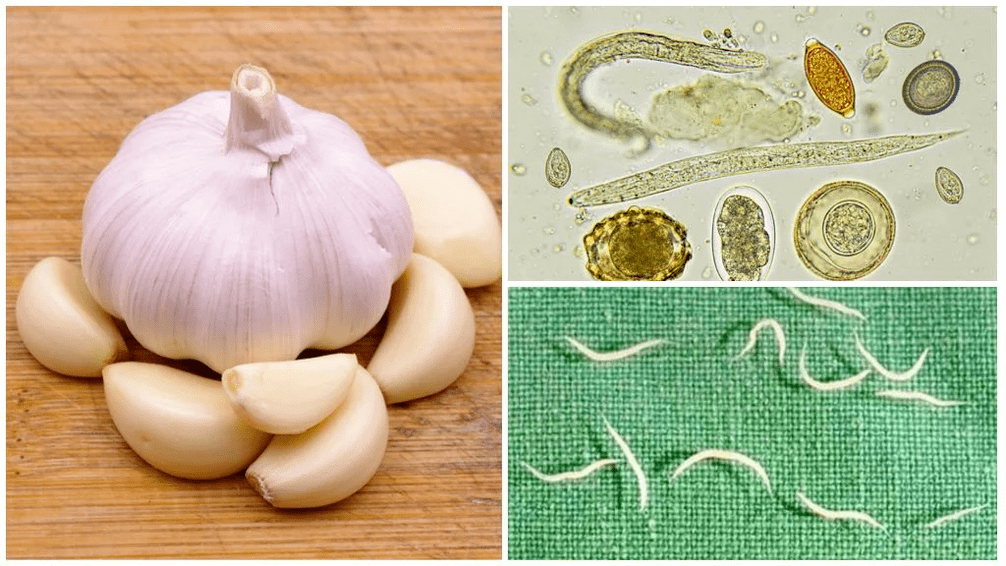 parasites in the popular body methods